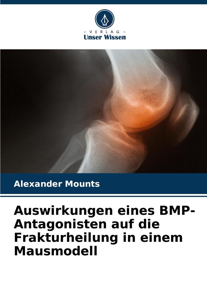 Auswirkungen eines BMP-Antagonisten auf die Frakturheilung in einem Mausmodell