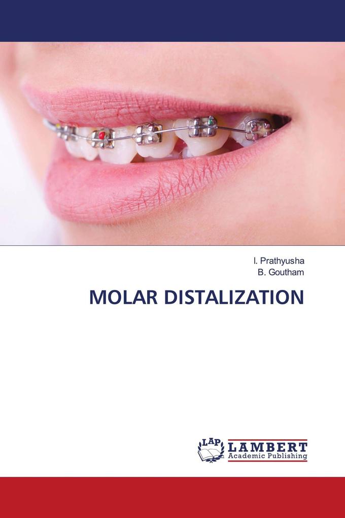 MOLAR DISTALIZATION