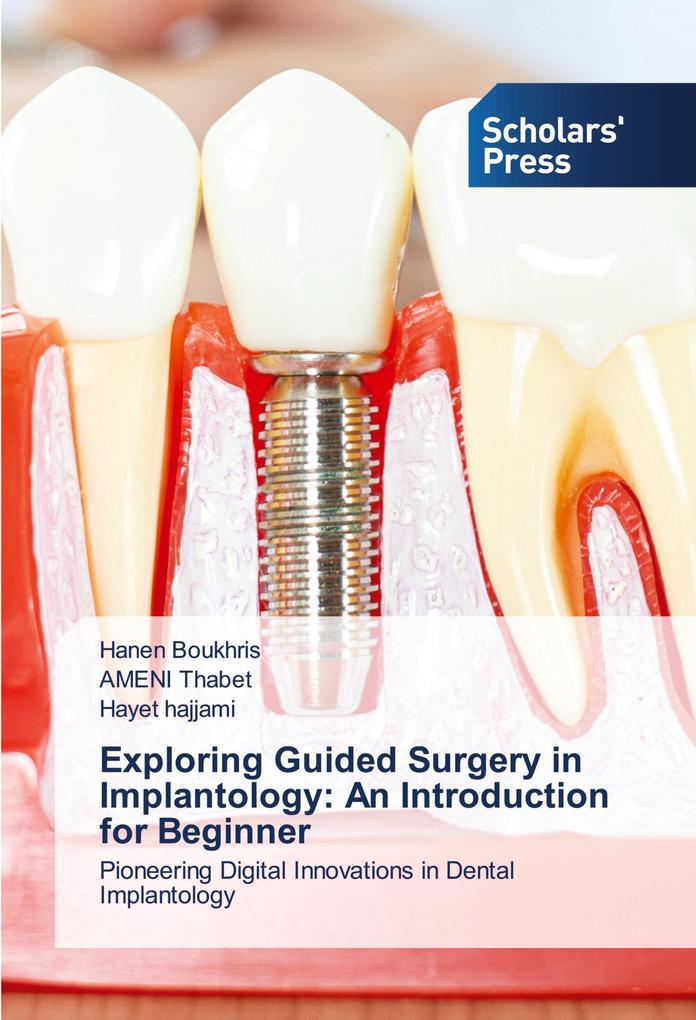 Exploring Guided Surgery in Implantology: An Introduction for Beginner