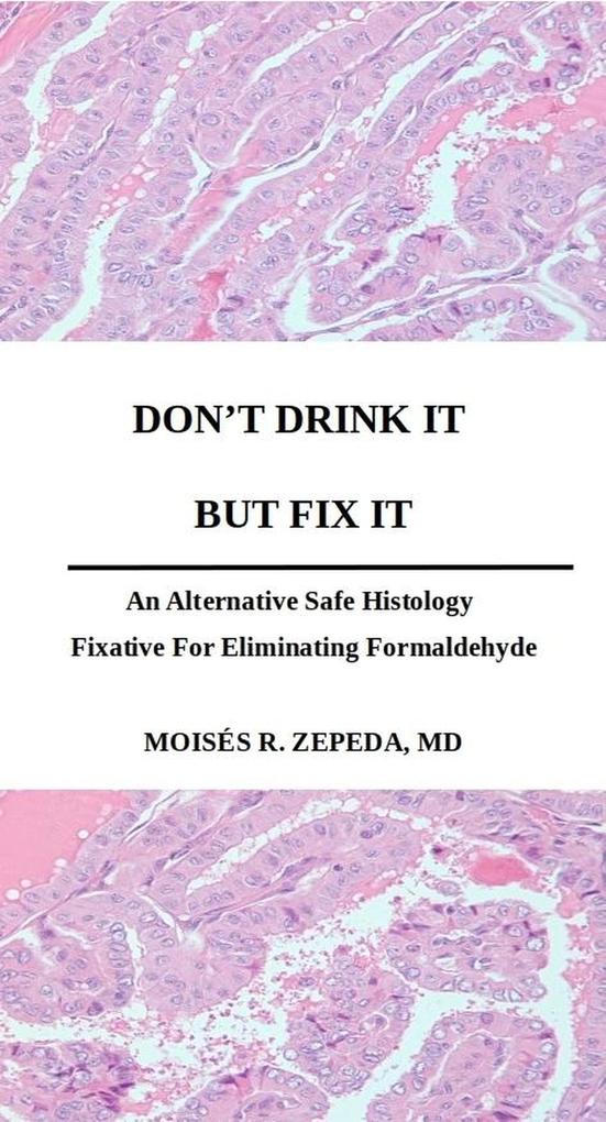 Don‘t Drink It But Fix It: An Alternative Safe Histology Fixative For Eliminating Formaldehyde