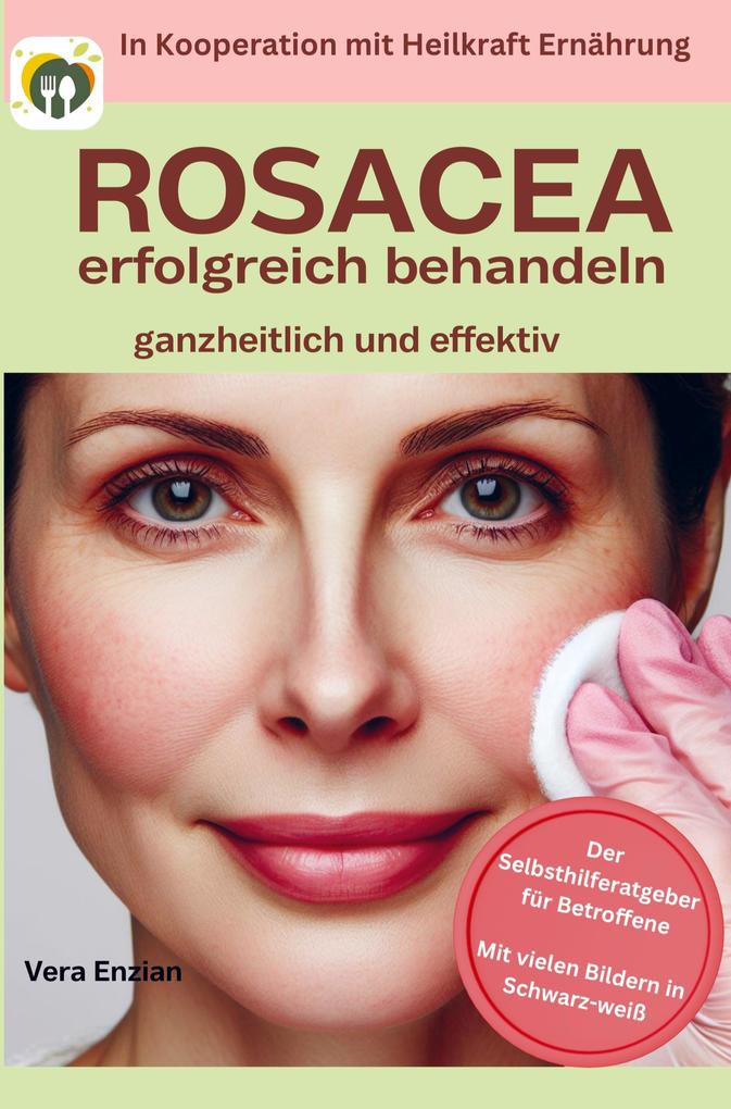 Rosacea erfolgreich behandeln - ganzheitlich und effektiv: Der Selbsthilferatgeber für Betroffene mit Tipps die wirklich funktionieren