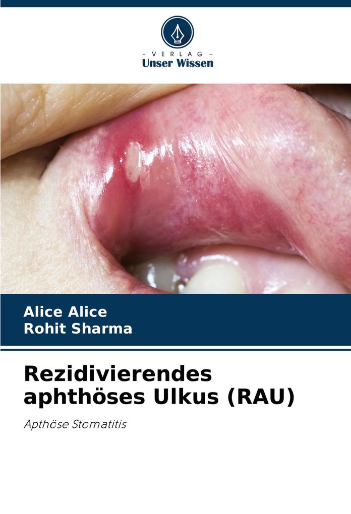 Rezidivierendes aphthöses Ulkus (RAU)