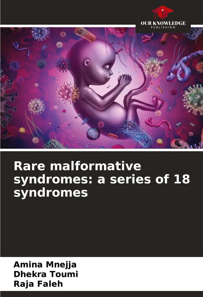 Rare malformative syndromes: a series of 18 syndromes