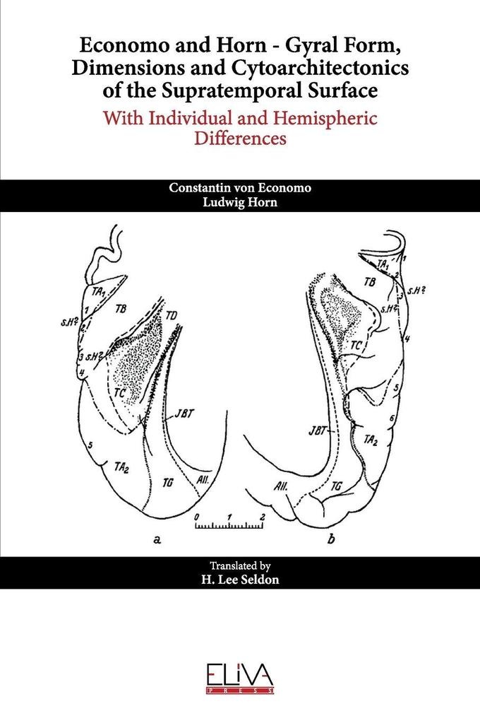 Economo and Horn - Gyral Form Dimensions and Cytoarchitectonics of the Supratemporal Surface