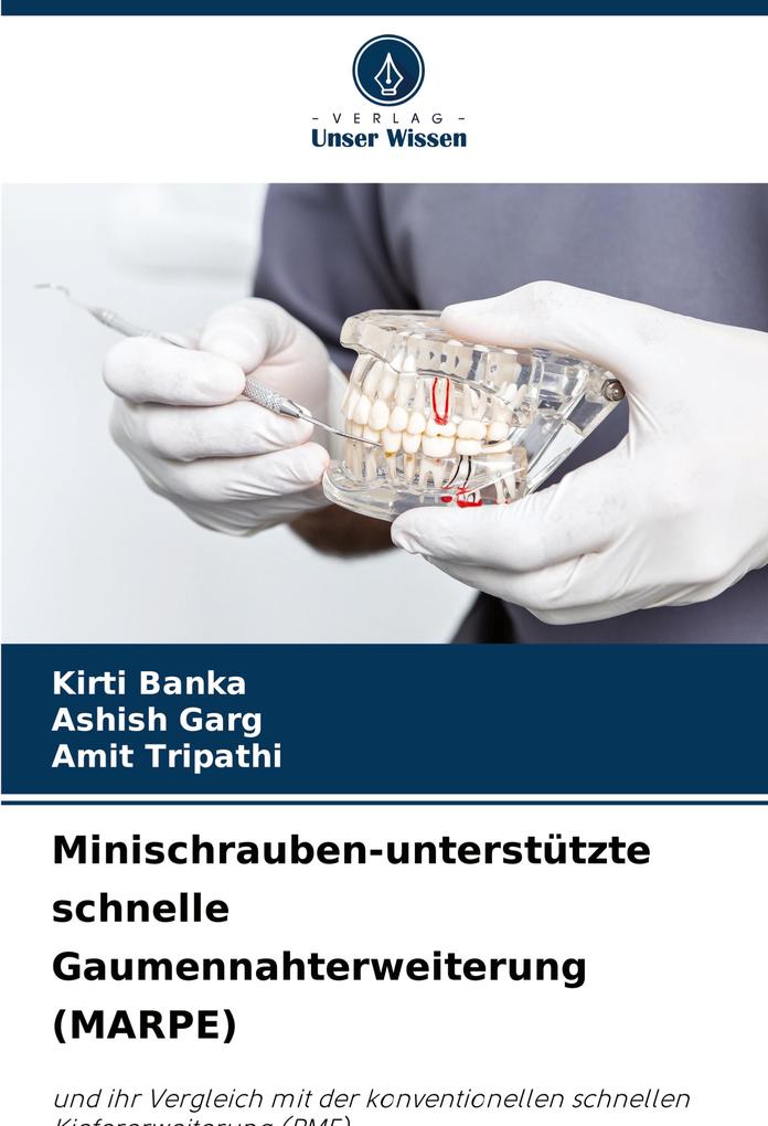 Minischrauben-unterstützte schnelle Gaumennahterweiterung (MARPE)