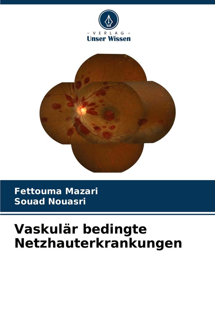 Vaskulär bedingte Netzhauterkrankungen