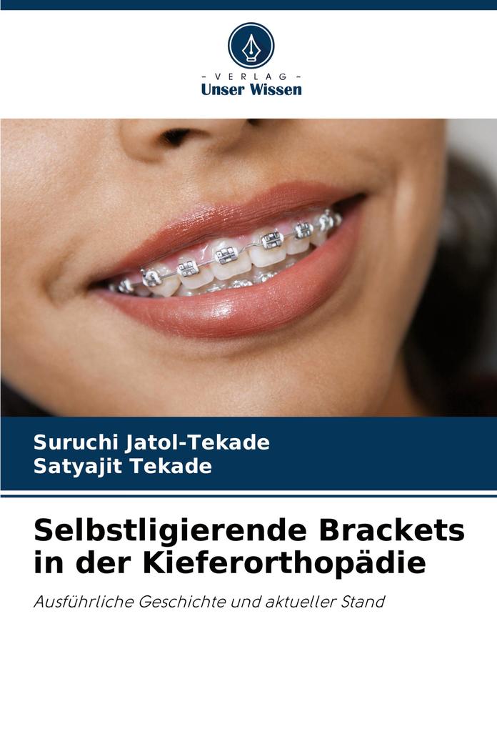 Selbstligierende Brackets in der Kieferorthopädie