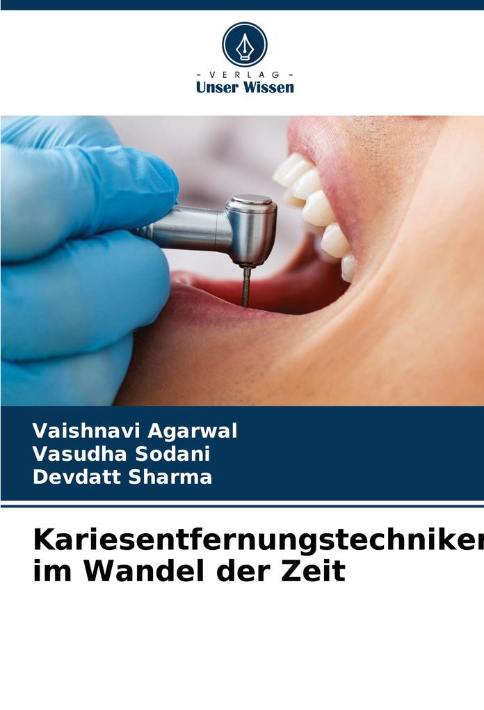Kariesentfernungstechniken im Wandel der Zeit