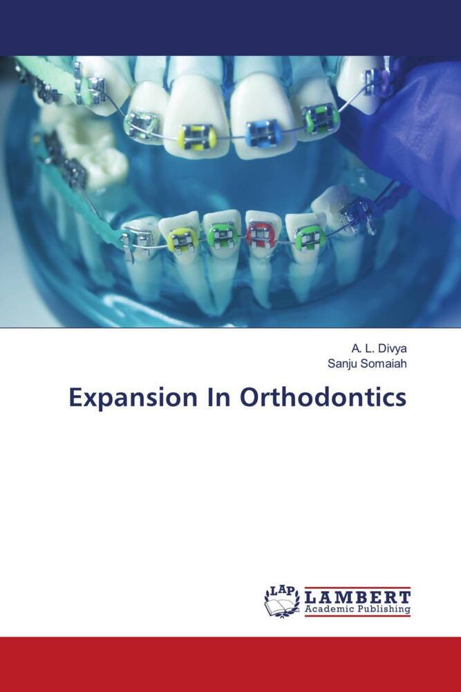 Expansion In Orthodontics