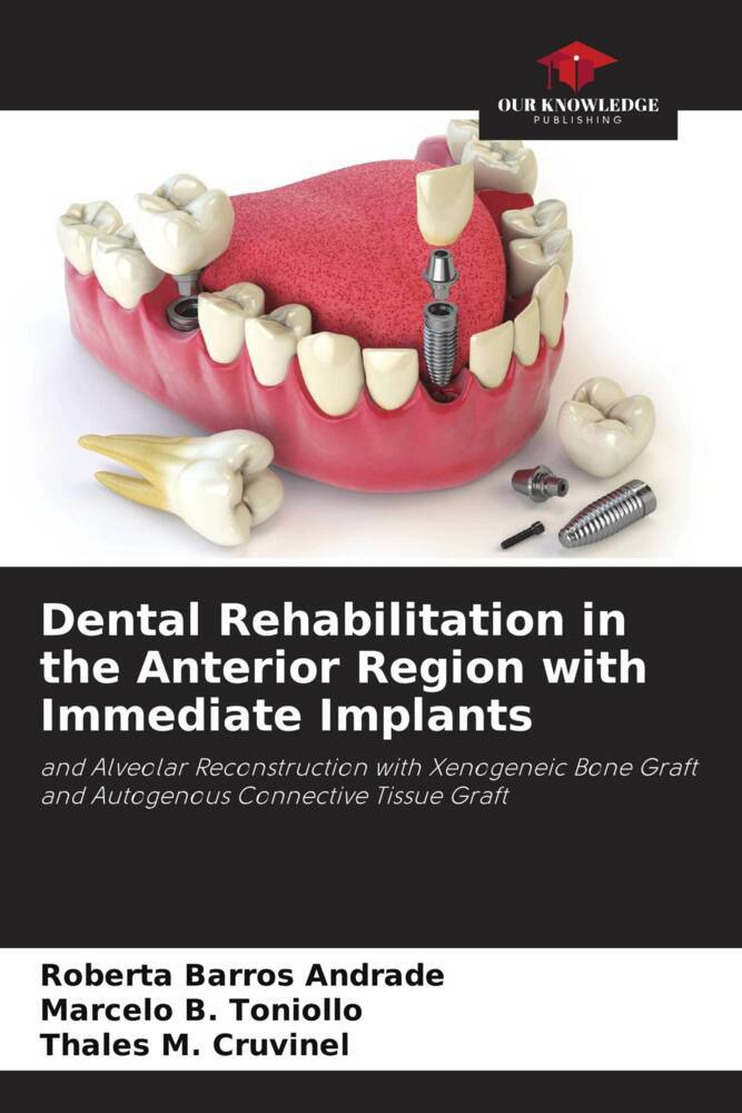 Dental Rehabilitation in the Anterior Region with Immediate Implants