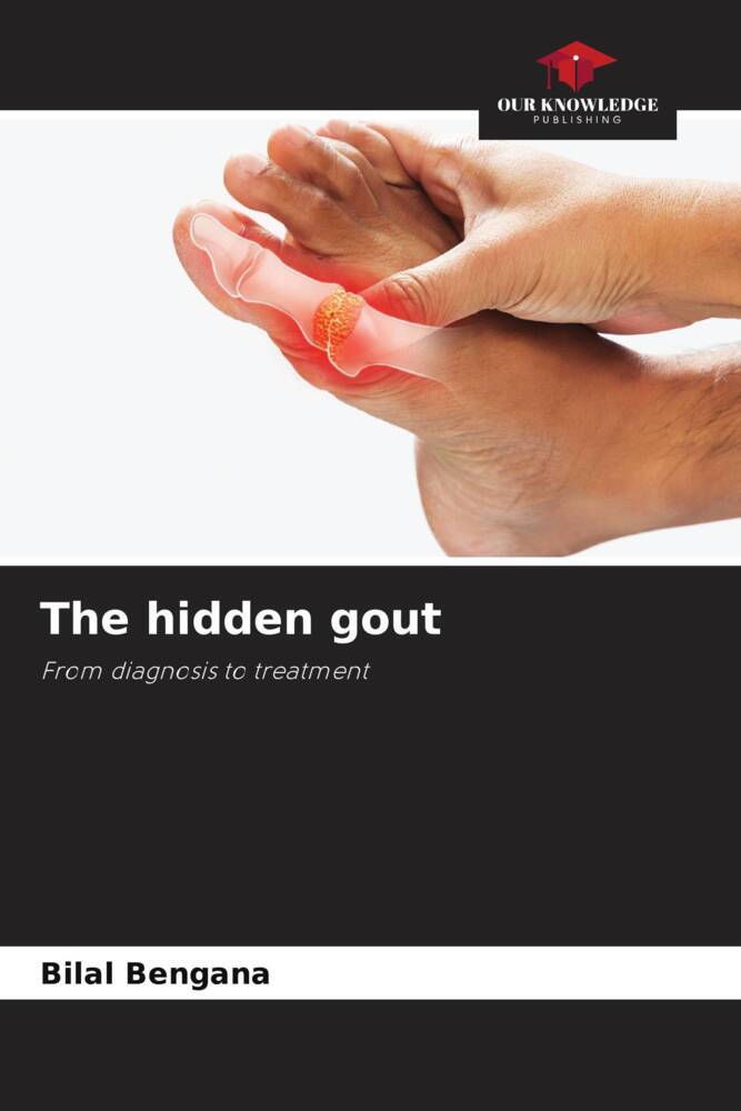 The hidden gout