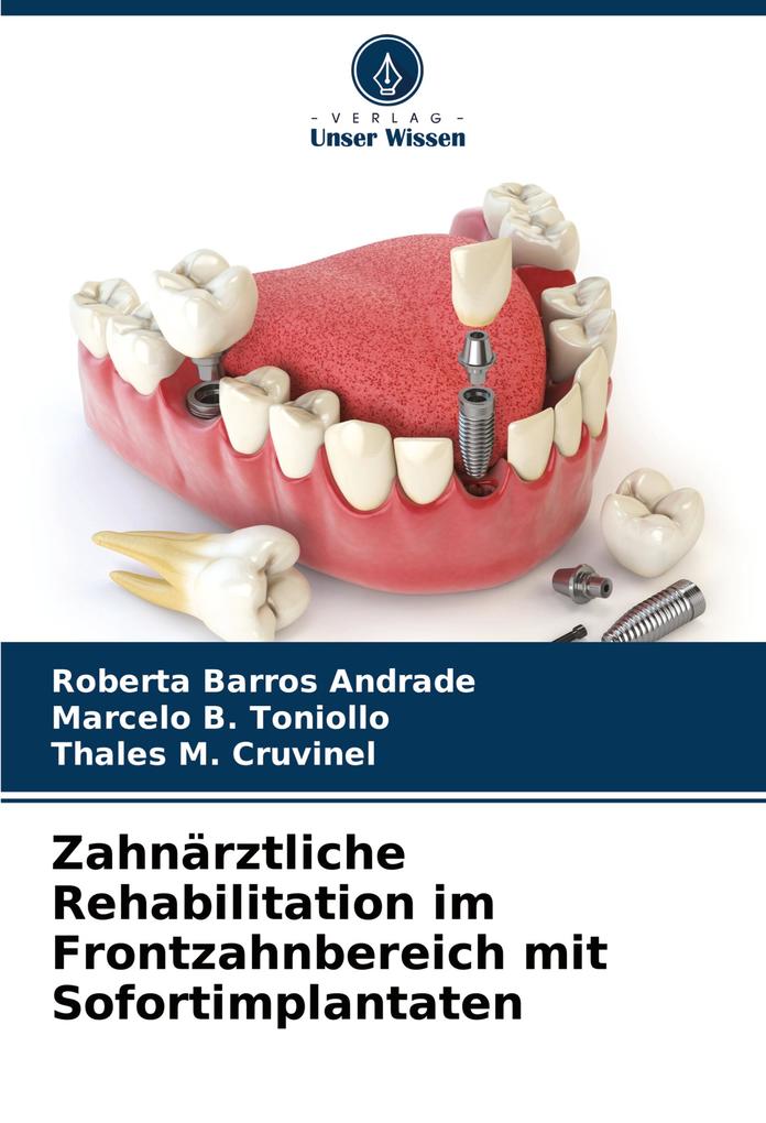 Zahnärztliche Rehabilitation im Frontzahnbereich mit Sofortimplantaten