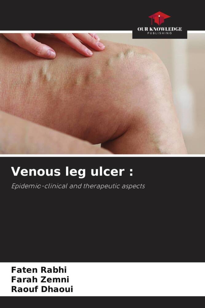 Venous leg ulcer :