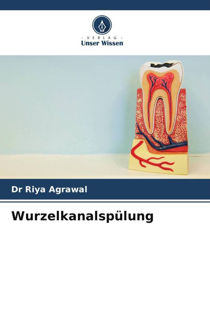 Wurzelkanalspülung