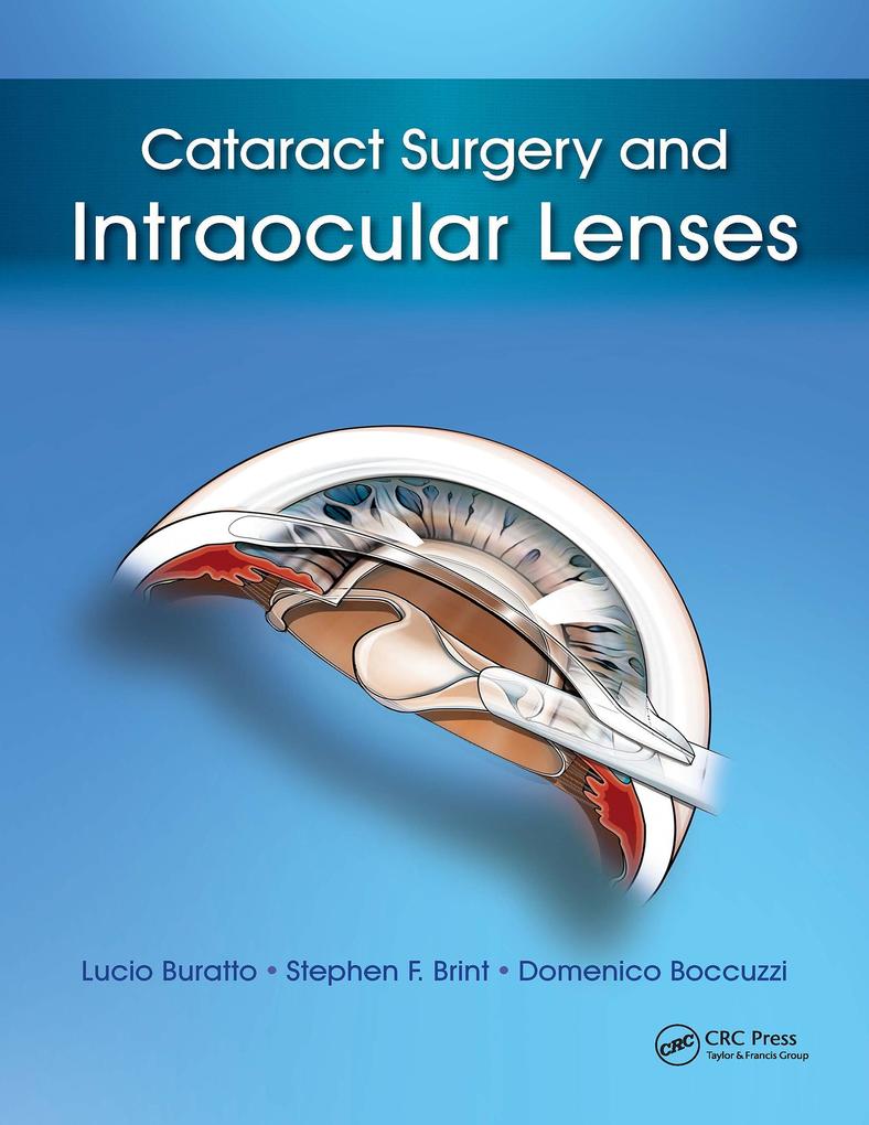 Cataract Surgery and Intraocular Lenses