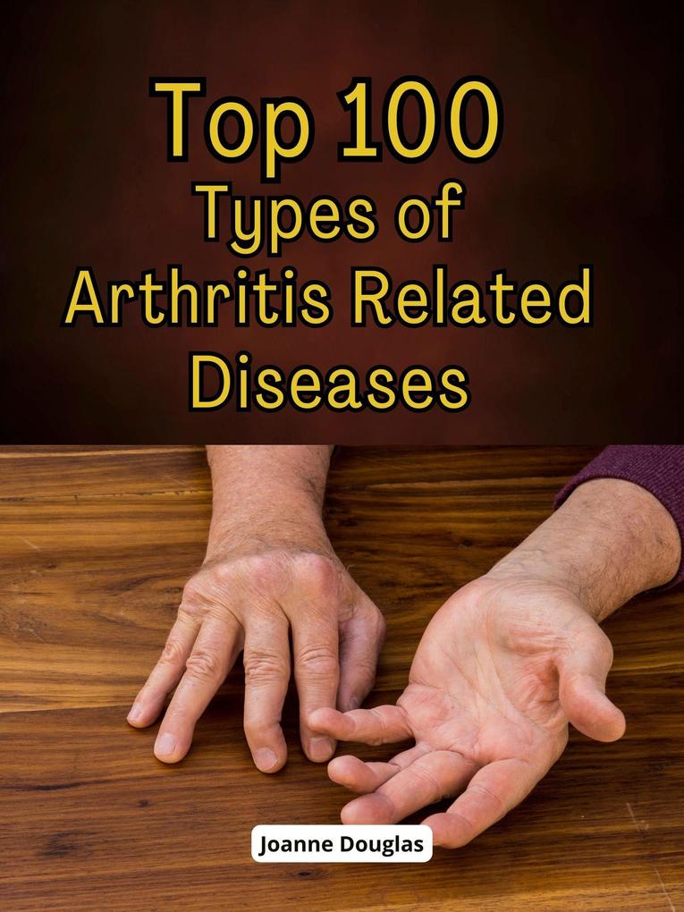 Top 100 Types of Arthritis Related Diseases