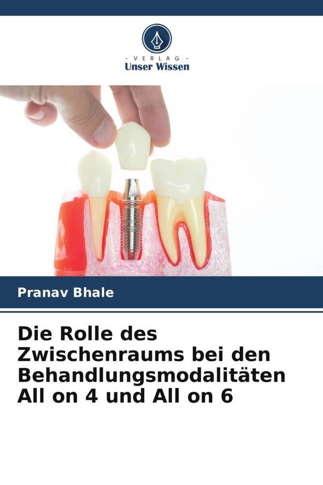 Die Rolle des Zwischenraums bei den Behandlungsmodalitäten All on 4 und All on 6