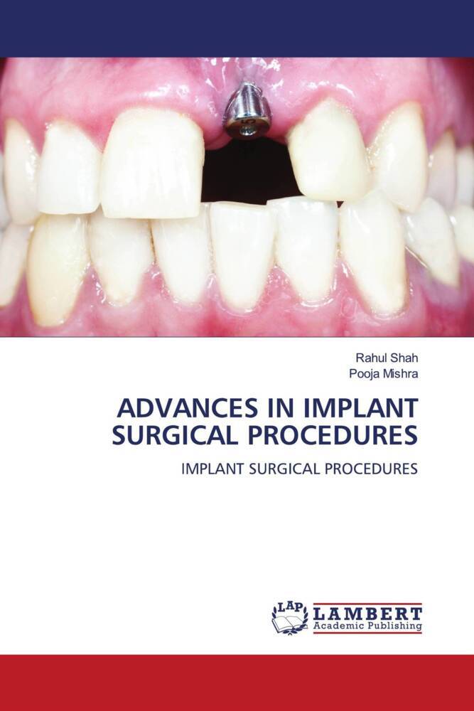 ADVANCES IN IMPLANT SURGICAL PROCEDURES