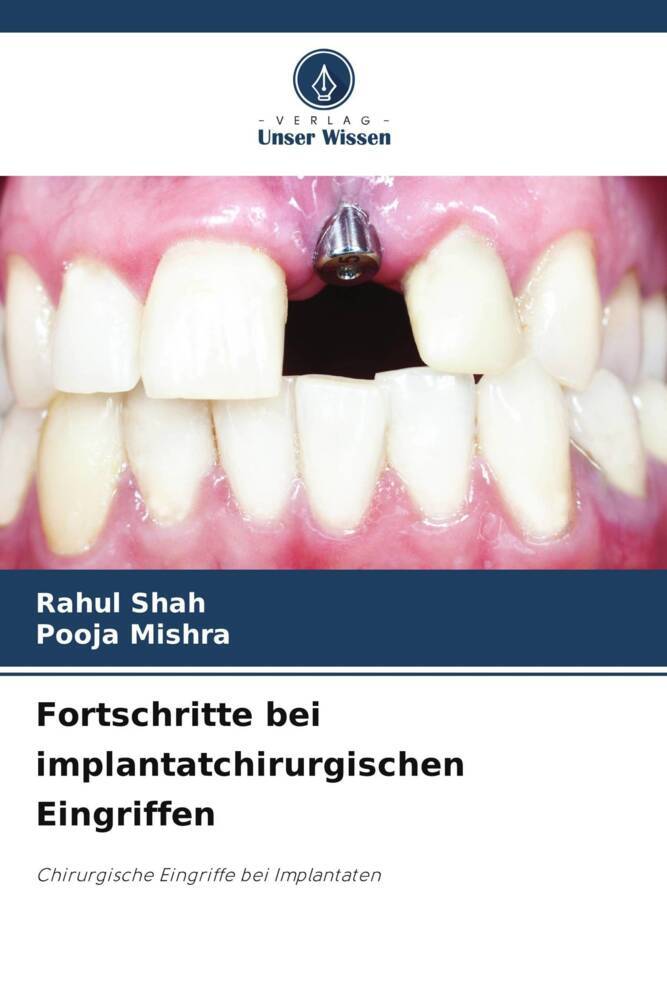 Fortschritte bei implantatchirurgischen Eingriffen