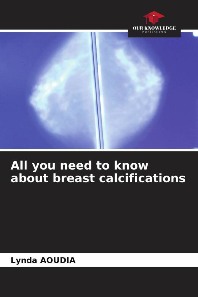 All you need to know about breast calcifications