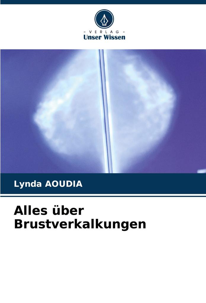 Alles über Brustverkalkungen