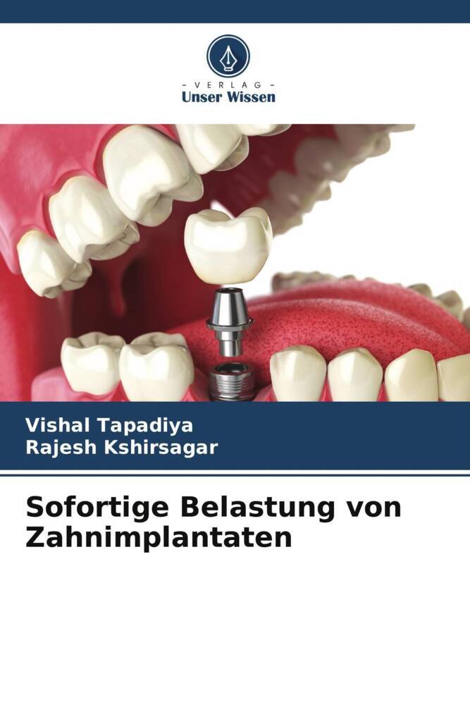 Sofortige Belastung von Zahnimplantaten