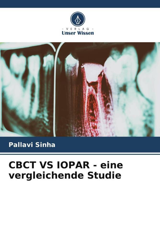 CBCT VS IOPAR - eine vergleichende Studie