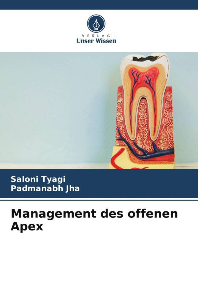 Management des offenen Apex