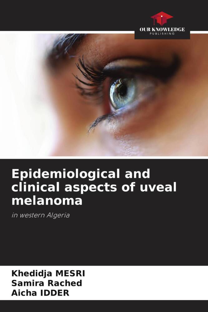 Epidemiological and clinical aspects of uveal melanoma