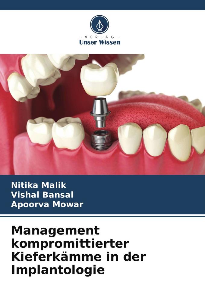 Management kompromittierter Kieferkämme in der Implantologie