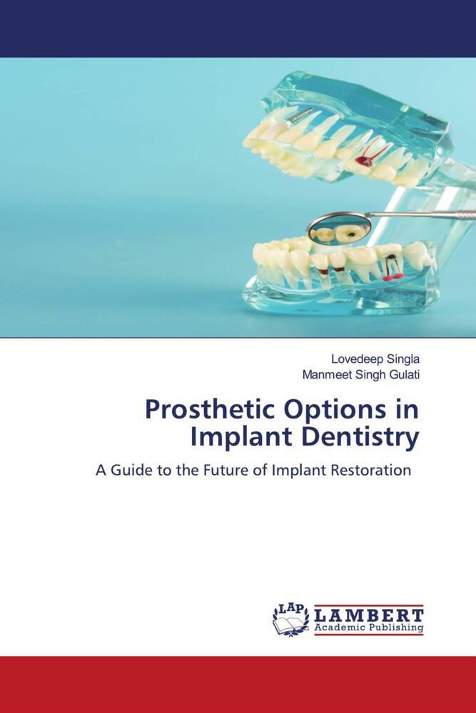 Prosthetic Options in Implant Dentistry