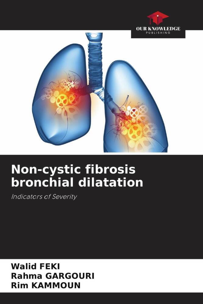 Non-cystic fibrosis bronchial dilatation