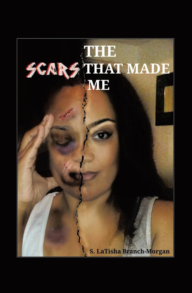 THE SCARS THAT MADE ME