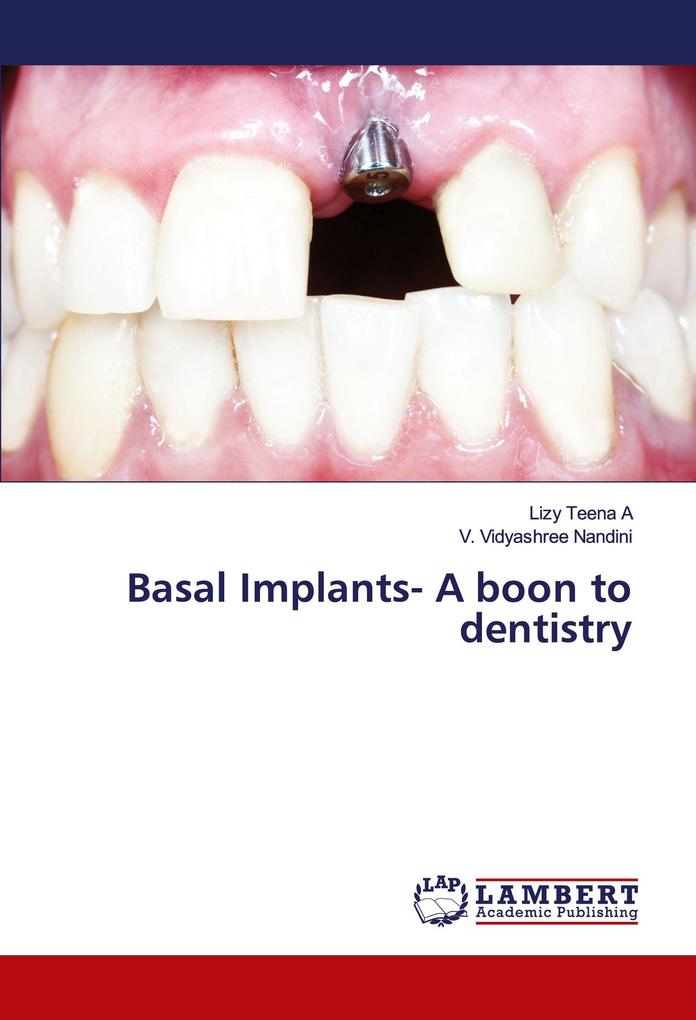 Basal Implants- A boon to dentistry
