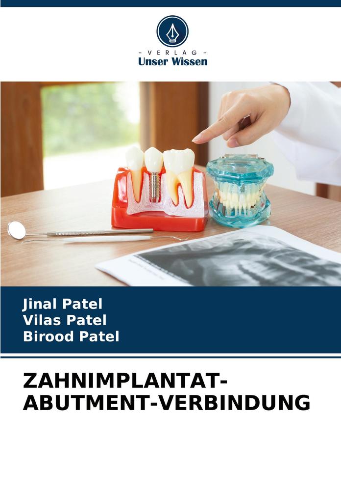 ZAHNIMPLANTAT-ABUTMENT-VERBINDUNG