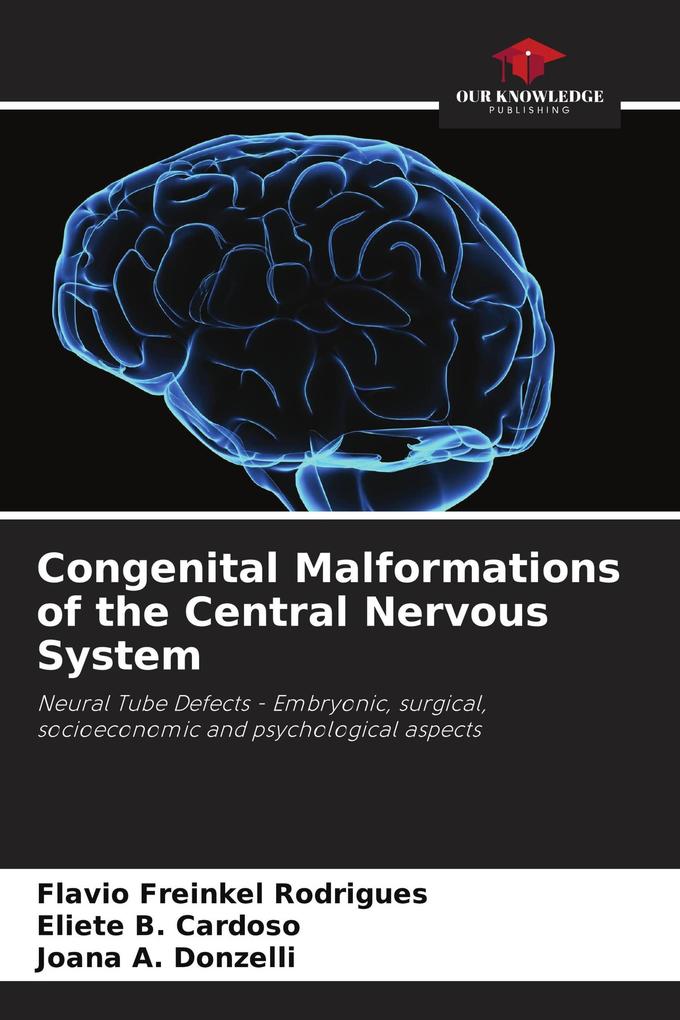 Congenital Malformations of the Central Nervous System