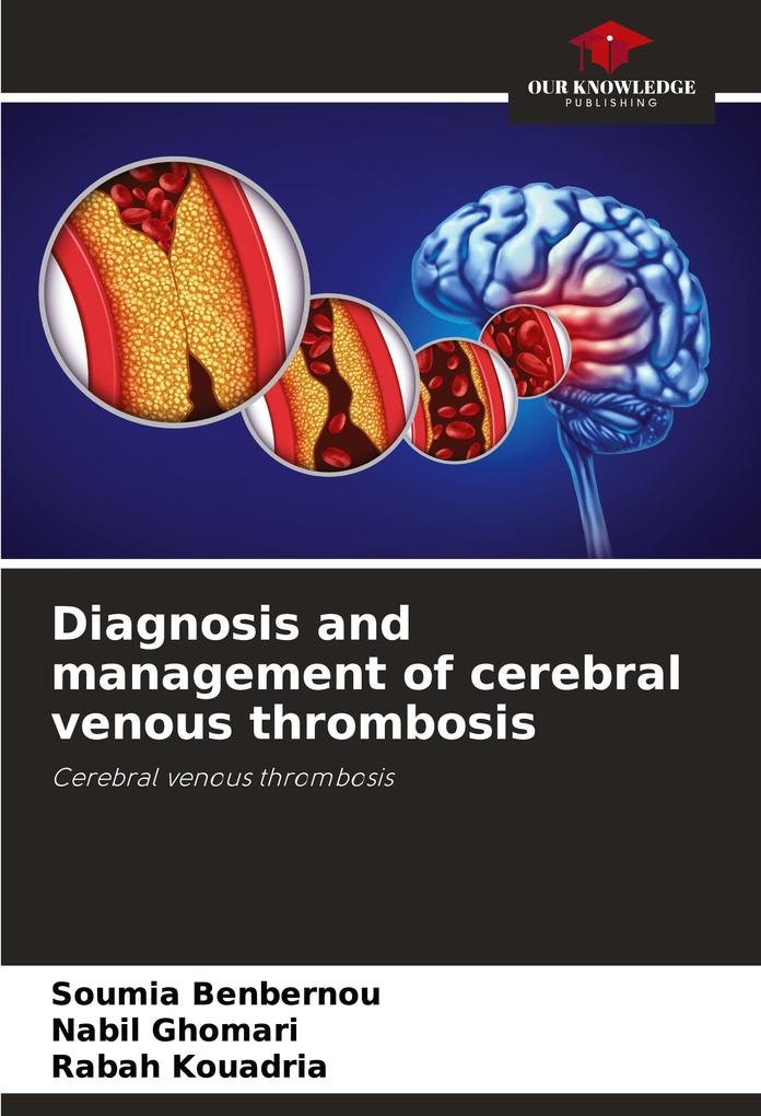 Diagnosis and management of cerebral venous thrombosis