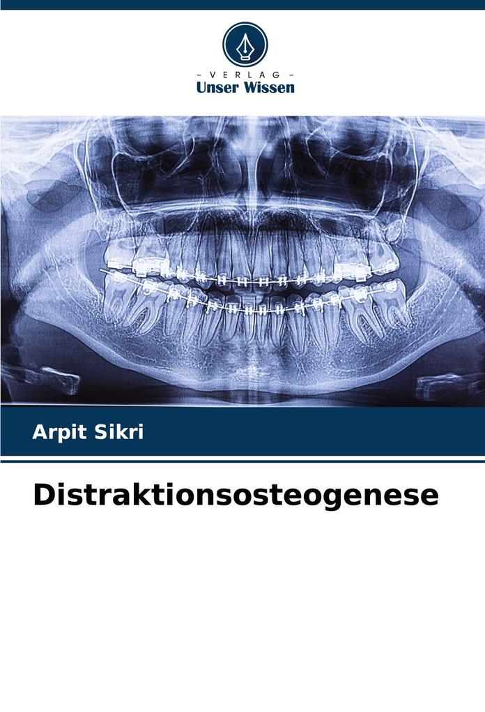 Distraktionsosteogenese