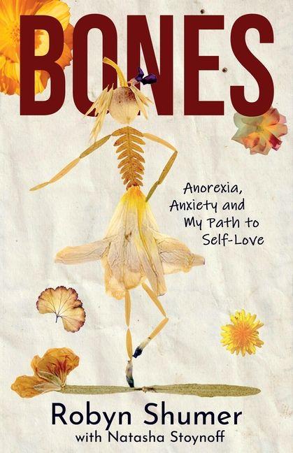 Bones