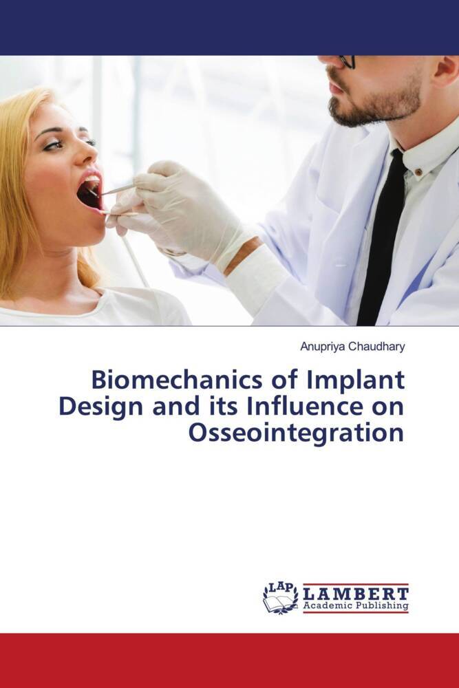 Biomechanics of Implant Design and its Influence on Osseointegration