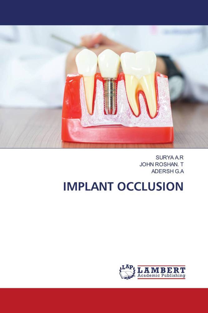 IMPLANT OCCLUSION