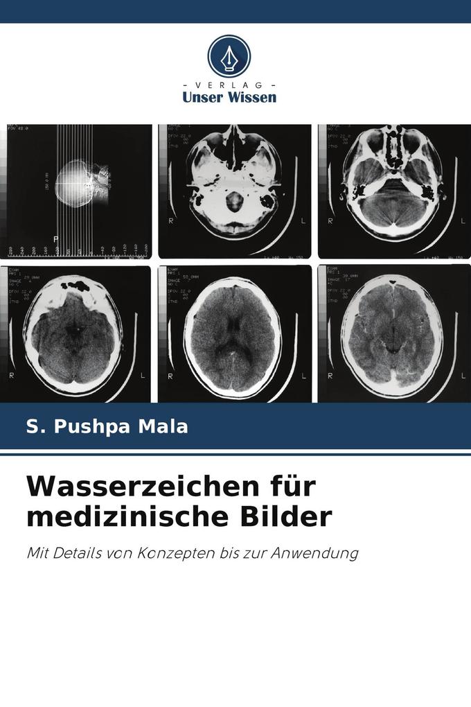 Wasserzeichen für medizinische Bilder