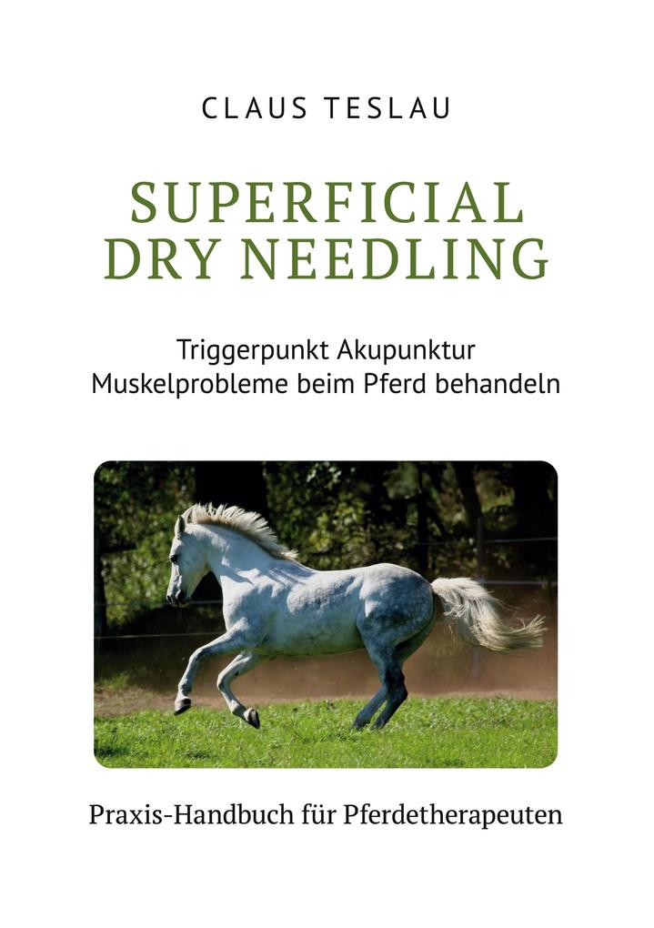 Superficial Dry Needling