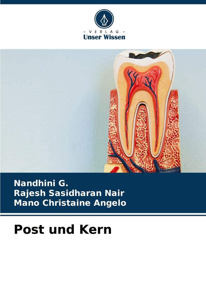 Post und Kern