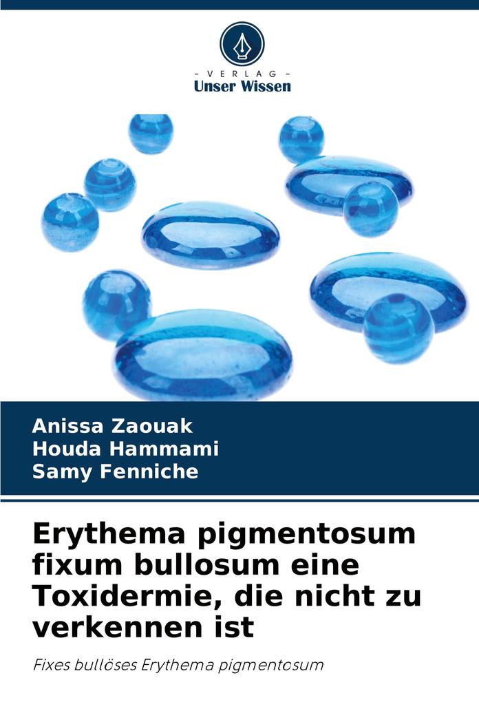 Erythema pigmentosum fixum bullosum eine Toxidermie die nicht zu verkennen ist
