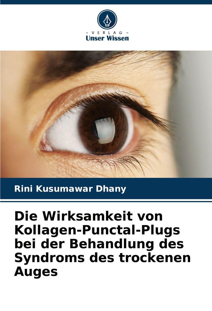 Die Wirksamkeit von Kollagen-Punctal-Plugs bei der Behandlung des Syndroms des trockenen Auges