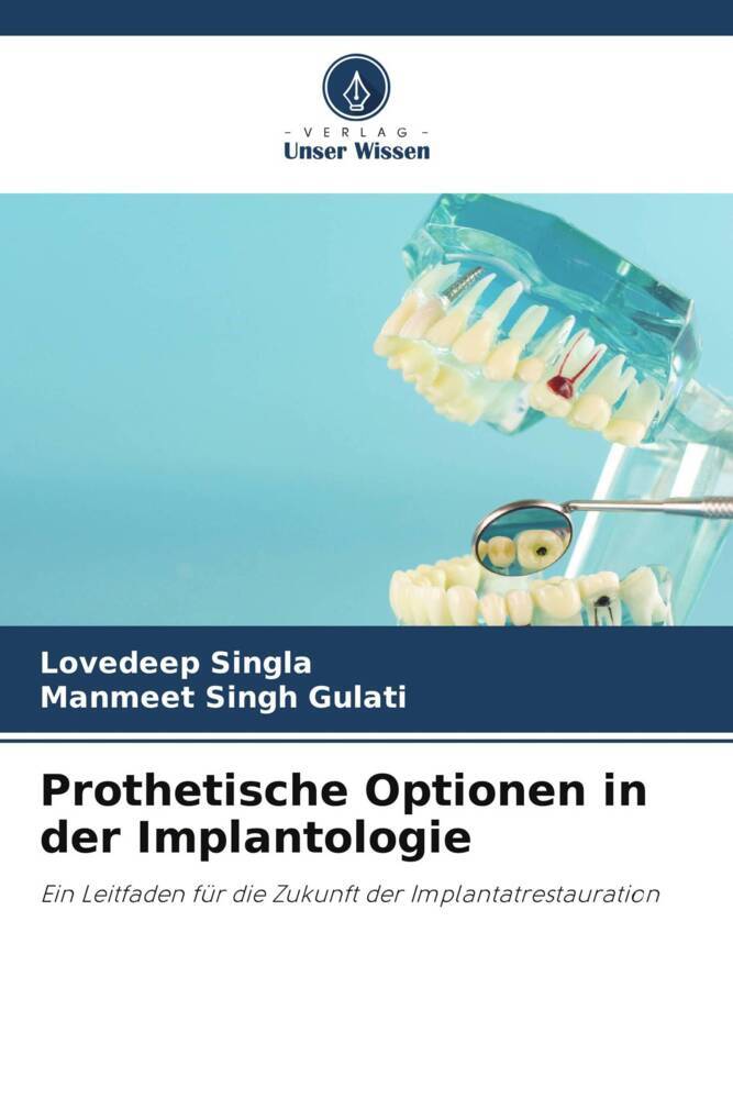 Prothetische Optionen in der Implantologie