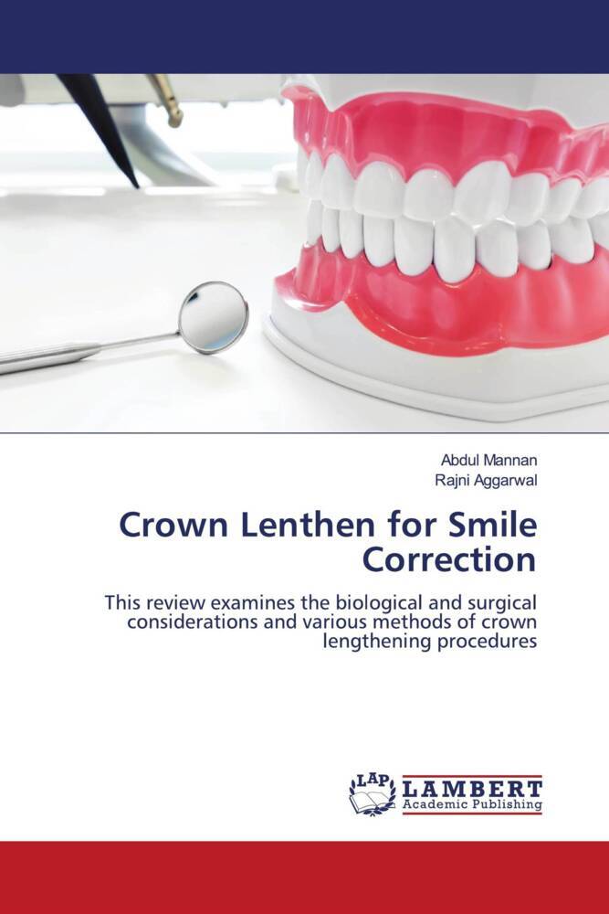 Crown Lenthen for Smile Correction