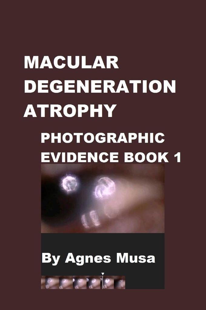 Macular Degeneration Atrophy Photographic Evidence Book 1 (Macular Degeneration Atrophy Photographic Evidence Series of Books #1)