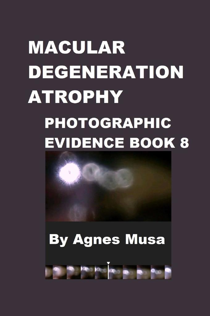 Macular Degeneration Photographic Evidence Book 8 (Macular Degeneration Atrophy Photographic Evidence Series of Books #11)